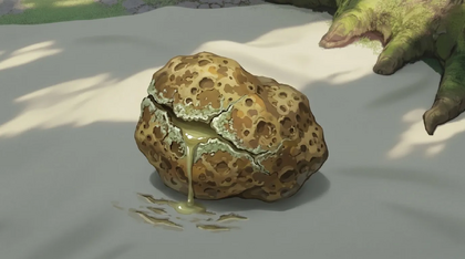 Bilemog Gallstone